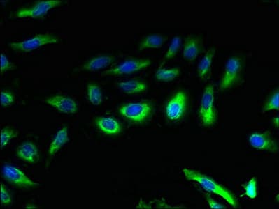 CCR4 Antibody