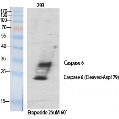 Polyclonal Rabbit anti-Human CASP6 / Caspase 6 Antibody (90-170 aa, Internal, IHC, WB)