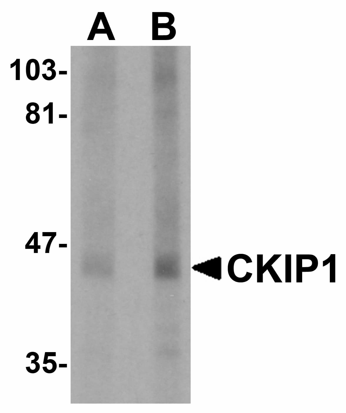 IHC-plus™ Polyclonal Rabbit anti-Human PLEKHO1 / CKIP-1 Antibody (IHC, WB)