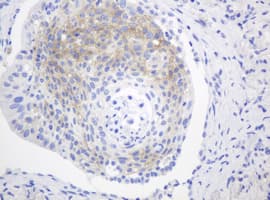 FGFR3 Antibody (aa23-375, clone OTI1B10)