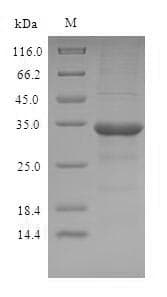 Human OBP2A Protein (Recombinant 6His-SUMO, N-terminus)