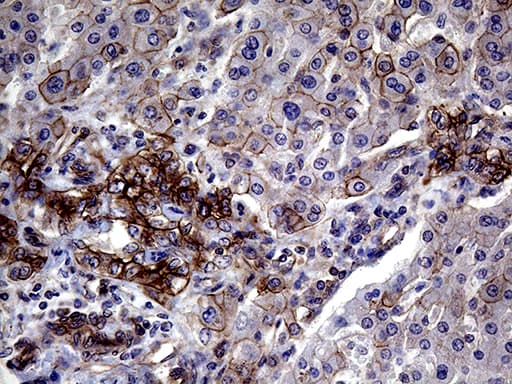 GLS2 / Glutaminase 2 Antibody (clone OTI4C10)