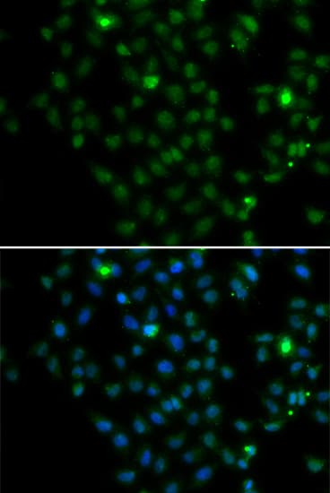 Polyclonal Rabbit anti-Human LMO4 Antibody (IF, WB)