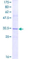 Human RTN3 / Reticulon 3 Protein (Recombinant GST, N-terminus)
