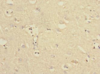 Polyclonal Rabbit anti-Human PTPN18 Antibody (IHC, WB)