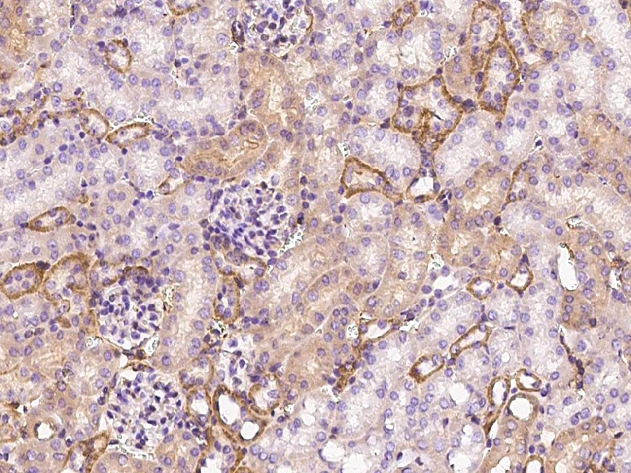 TIE1 / TIE Antibody