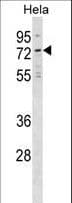 NET1 / ARHGEF8 Antibody (aa356-385)