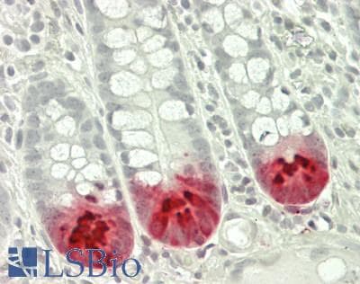 PathPlus™ Monoclonal Mouse anti-Human LYZ / Lysozyme Antibody (clone LZ-2, IHC)