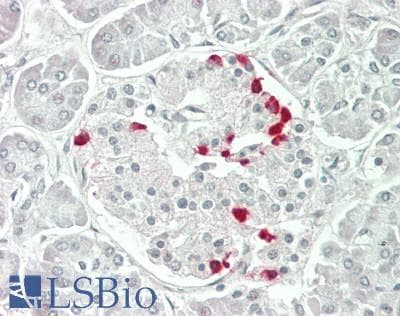 IHC-plus™ ASAP2 / DDEF2 Antibody (Internal)