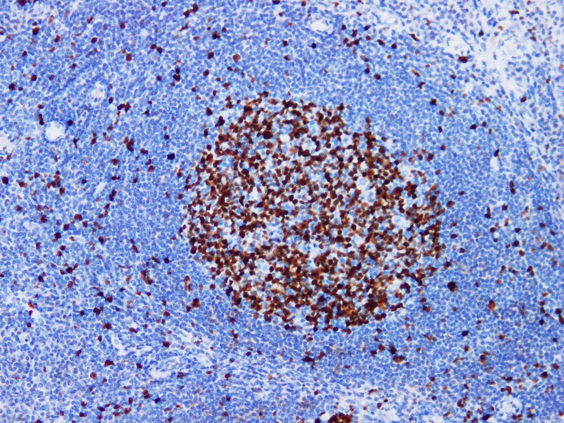 MKI67 / Ki67 Antibody