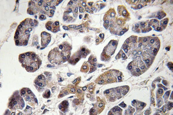 MRPS21 Antibody (Gln85)