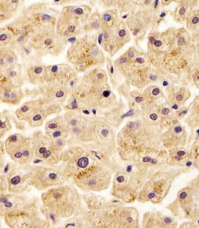 Polyclonal Rabbit anti-Human SLC29A2 / ENT2 Antibody (N-Terminus, IHC, WB)