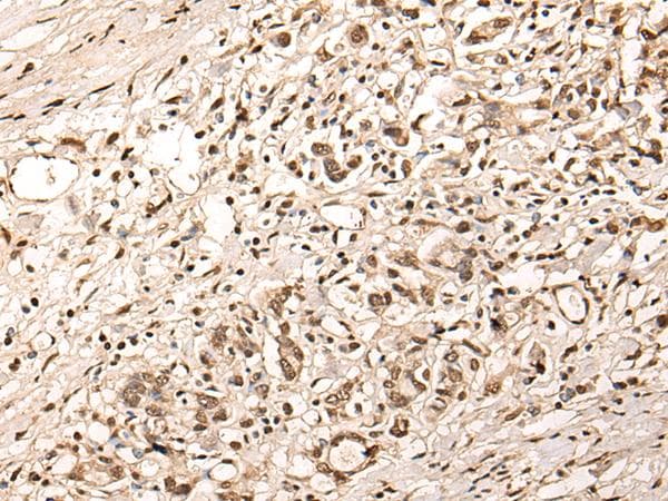 Polyclonal Rabbit anti-Human ZSCAN12 Antibody (IHC)