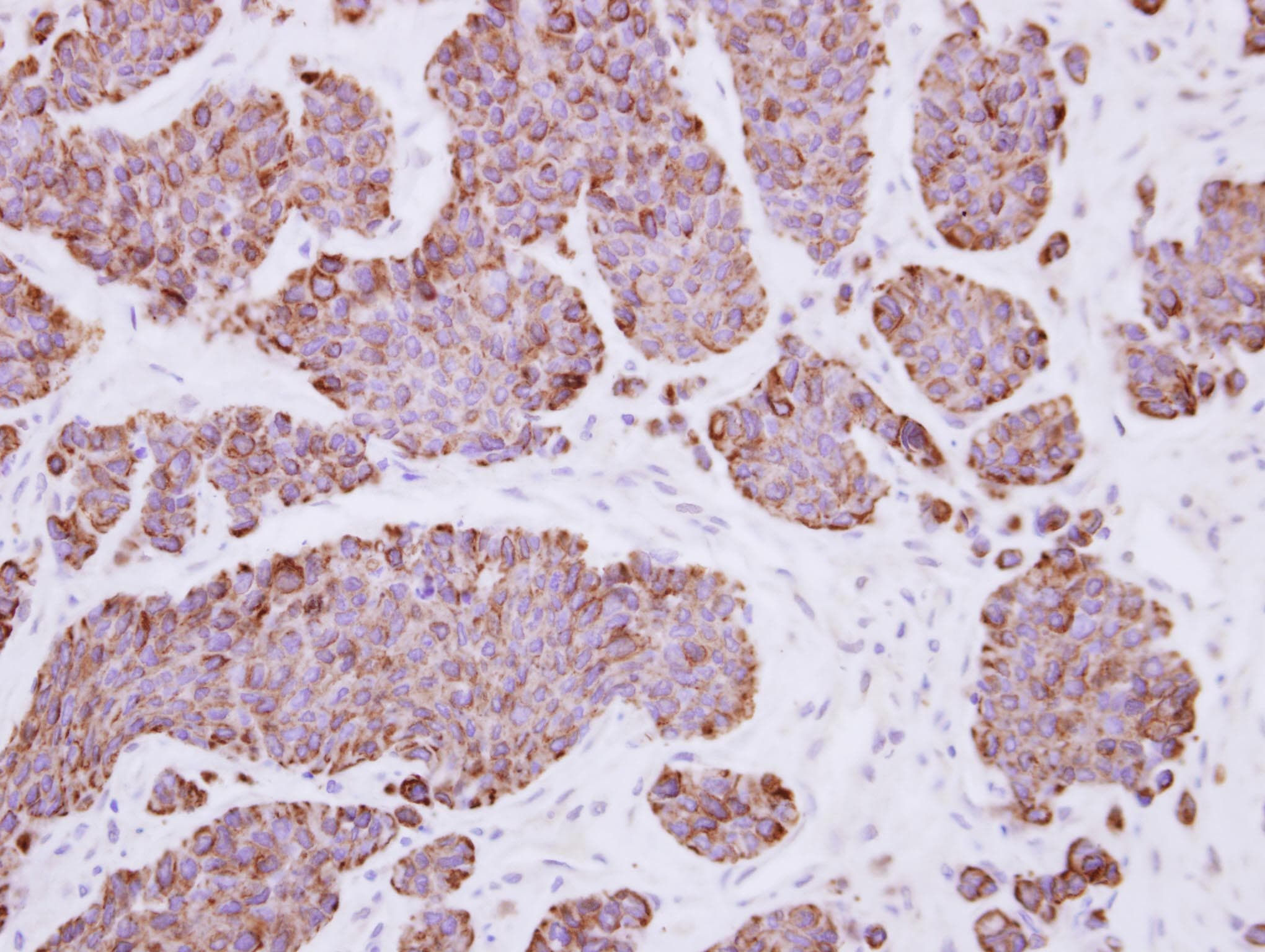 PLEKHF2 Antibody