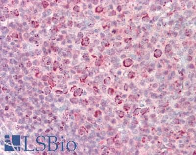 IHC-plus™ MRPL54 Antibody (aa72-121)
