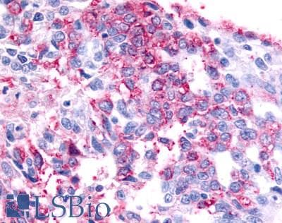 PathPlus™ Polyclonal Rabbit anti-Human GPR45 Antibody (Cytoplasmic Domain, IHC)