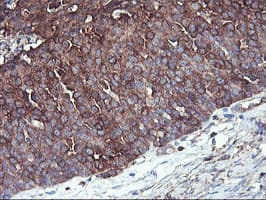 PFKP Antibody (clone OTI1D6)