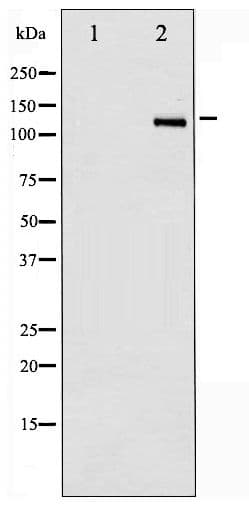 Polyclonal Rabbit anti-Human HDAC6 Antibody (phospho-Ser22, IHC, IF, WB)