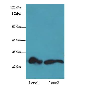 Polyclonal Rabbit anti-Human FKBP11 Antibody (IHC, WB)
