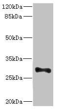 Polyclonal Rabbit anti-Human ICAM4 / CD242 Antibody (IHC, WB)