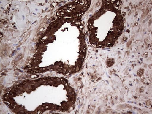 PKM2 Antibody (clone 1G10)