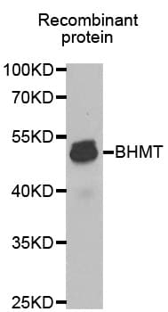 Polyclonal Rabbit anti-Human BHMT Antibody (IHC, WB)