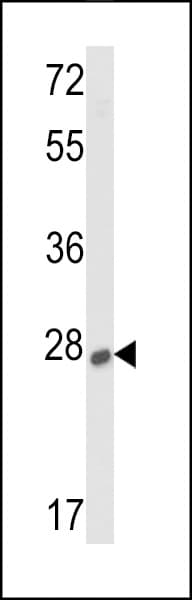 Polyclonal Rabbit anti-Human SOST / Sclerostin Antibody (aa134-163, IHC, WB)