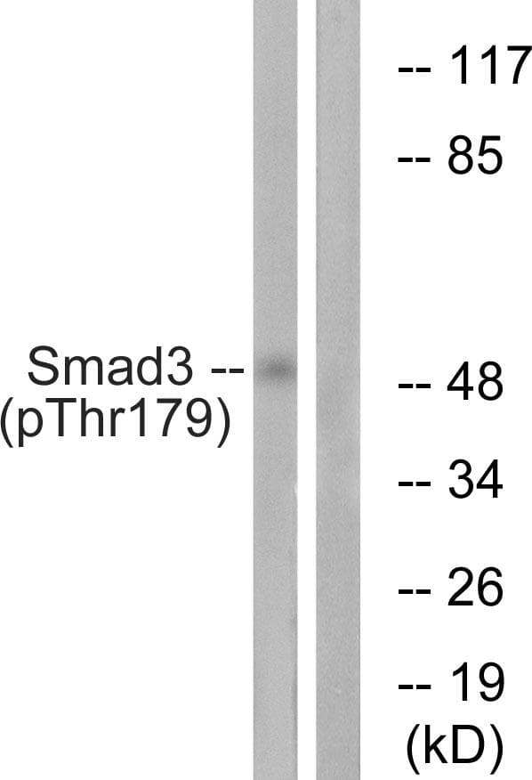 SMAD3 Antibody (phospho-Thr179)
