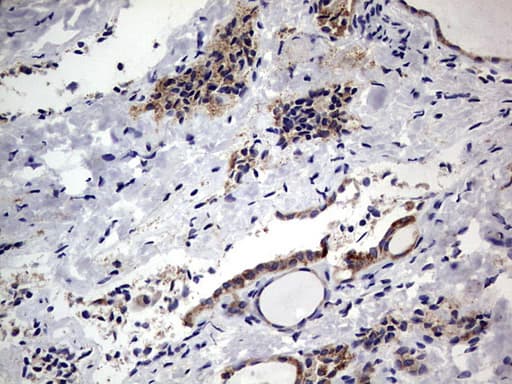 PRX-1 / PRRX1 Antibody (clone OTI1E10)