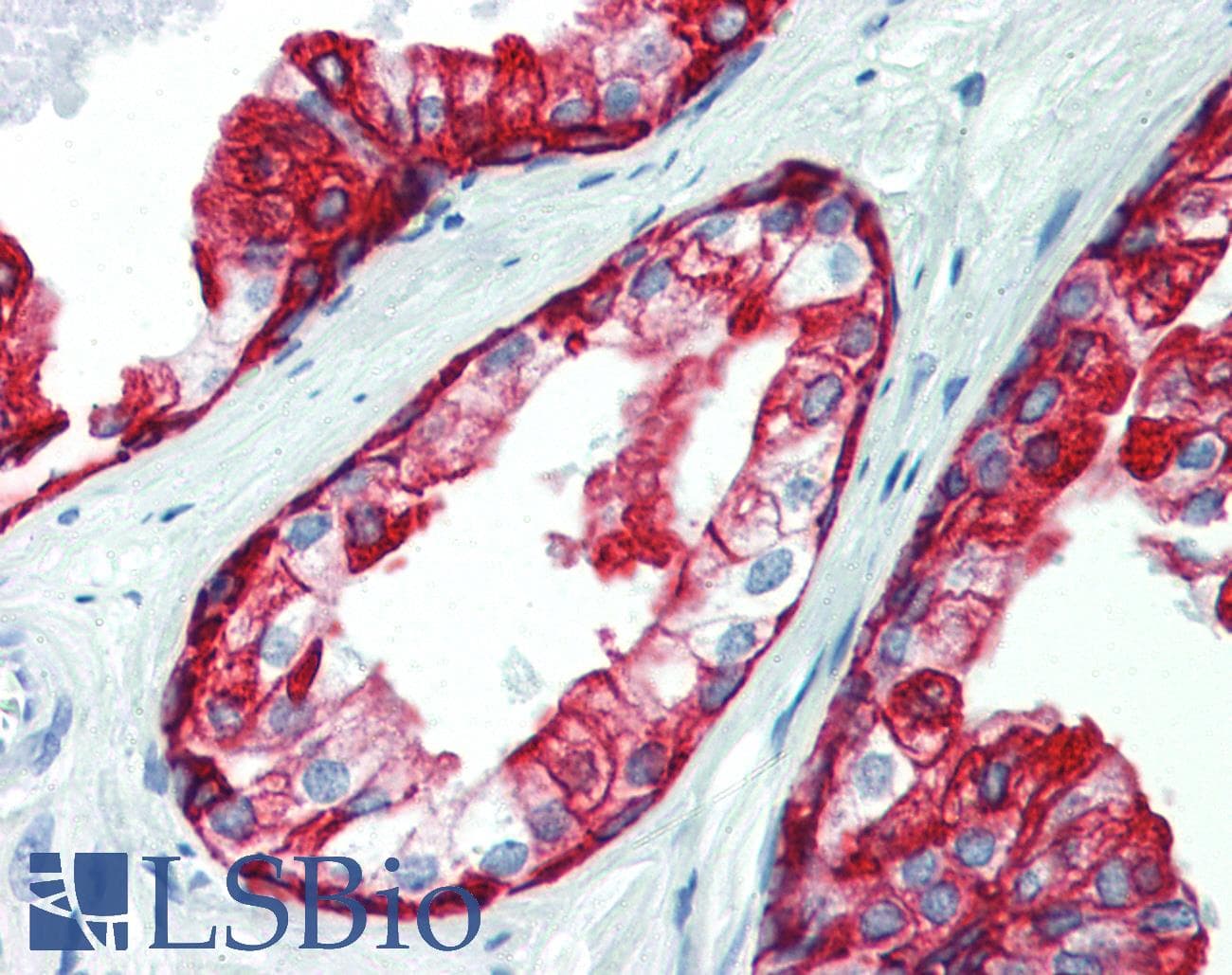PathPlus™ Polyclonal Rabbit anti-Human KRT19 / CK19 / Cytokeratin 19 Antibody (clone E16-L, C-Terminus, IHC)