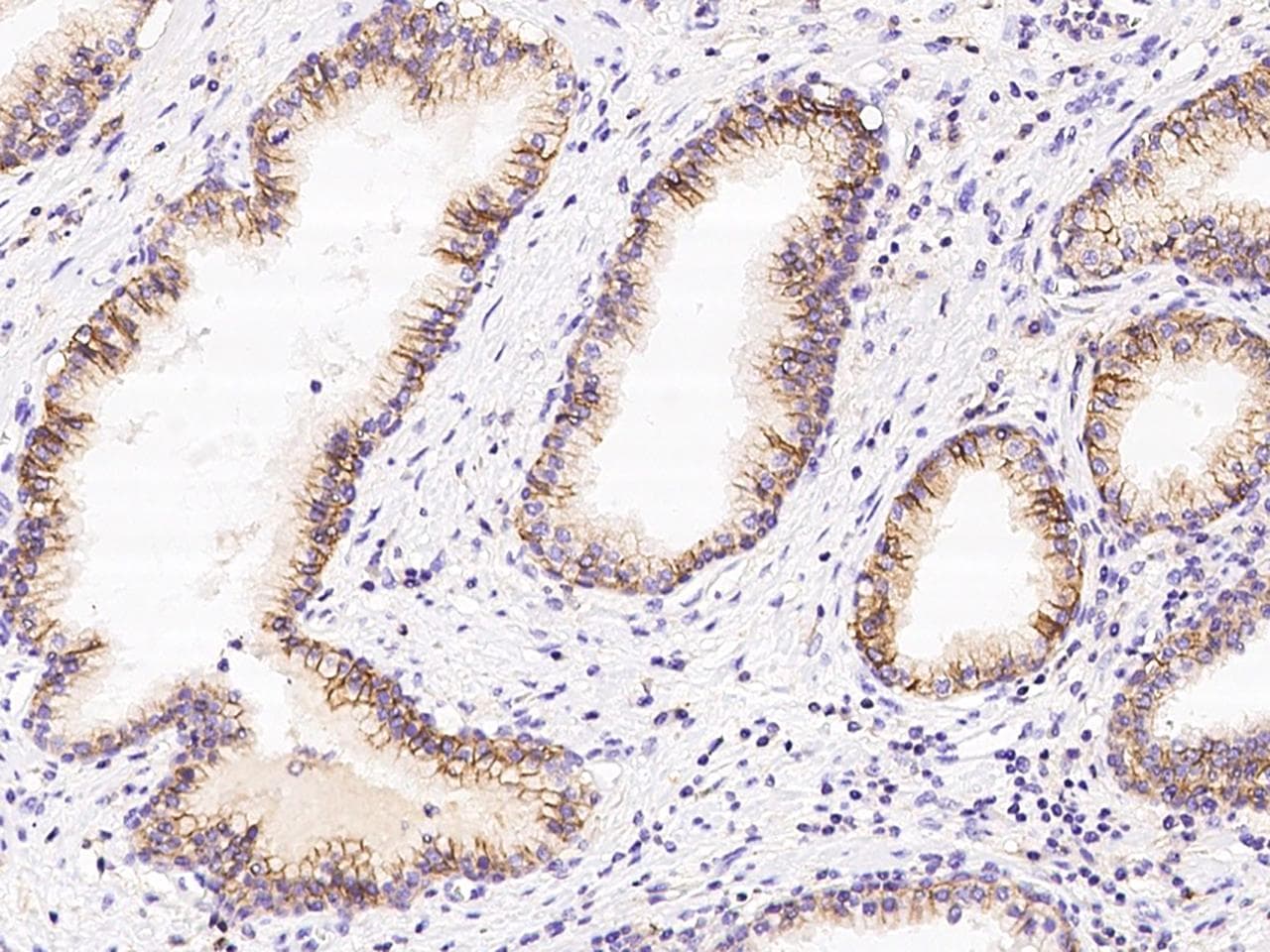Polyclonal Rabbit anti-Human CD47 Antibody (IHC, IF)
