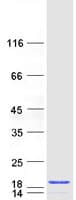 Human PFDN6 / HKE2 Protein (Recombinant Myc-DDK (Flag))