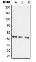 MMP14 Antibody (Internal)