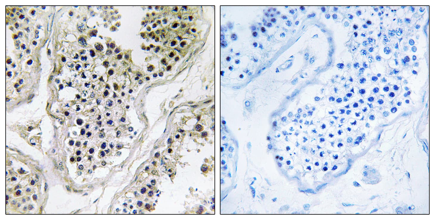 ATXN7L1 Antibody (aa441-490)