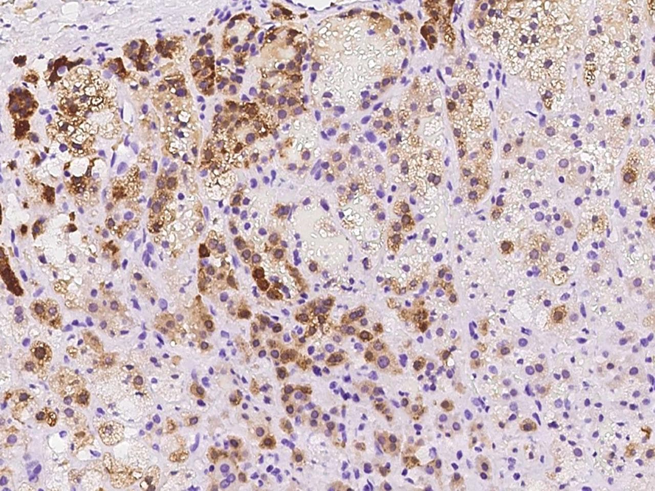 EDR / PEG10 Antibody