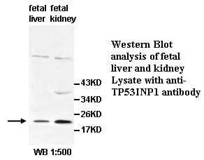 Polyclonal Rabbit anti-Human SIP / TP53INP1 Antibody (IHC, WB)