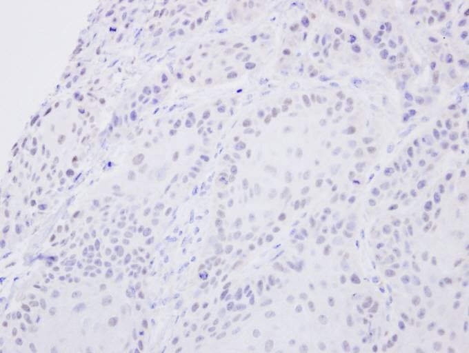 SENP2 Antibody (aa1-62)