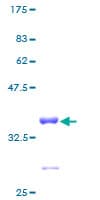 Human RPL23 / Ribosomal Protein L23 (Recombinant GST)