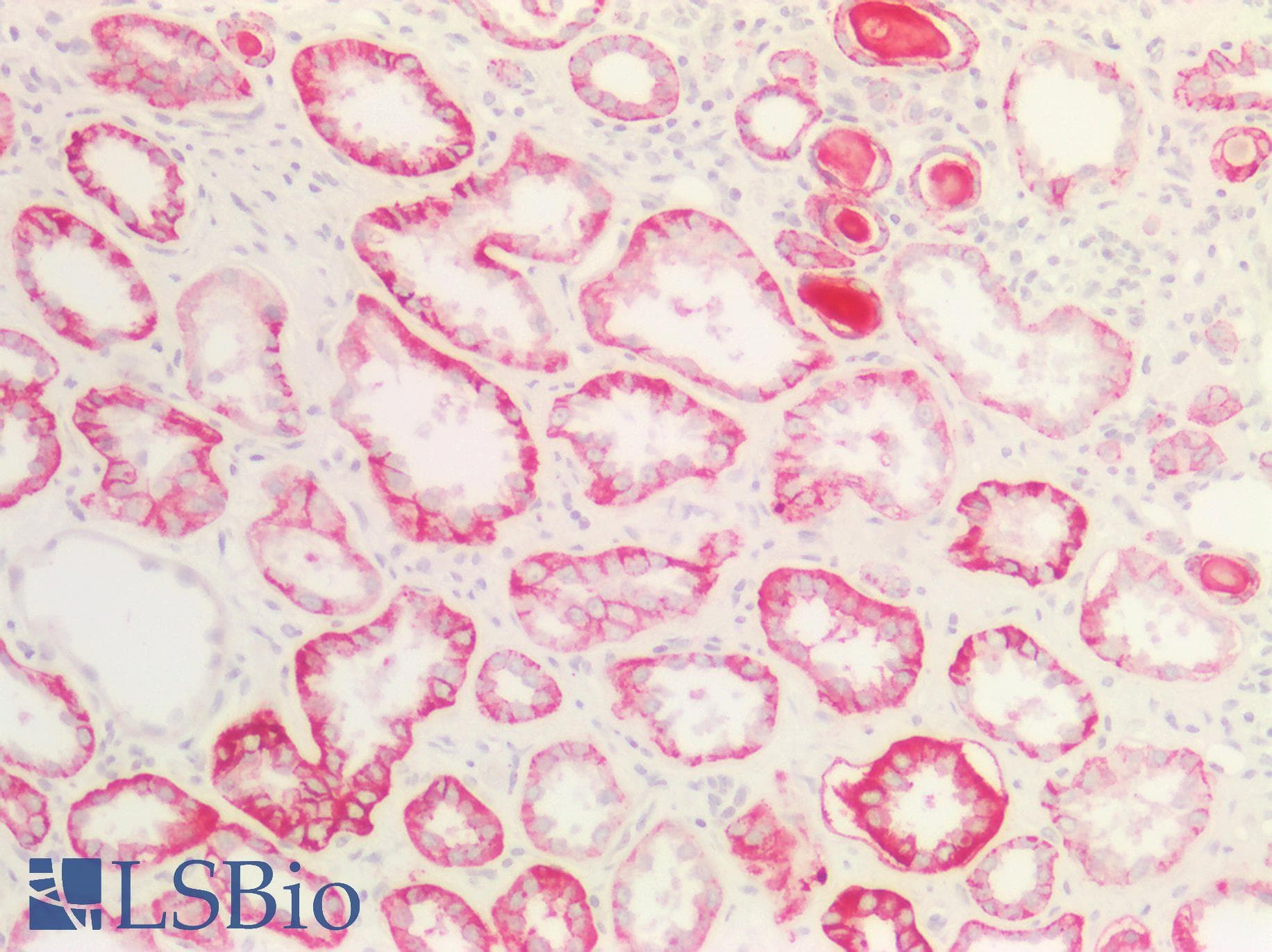 PathPlus™ CLDN4 / Claudin 4 Antibody (130-210 aa, C-terminal)