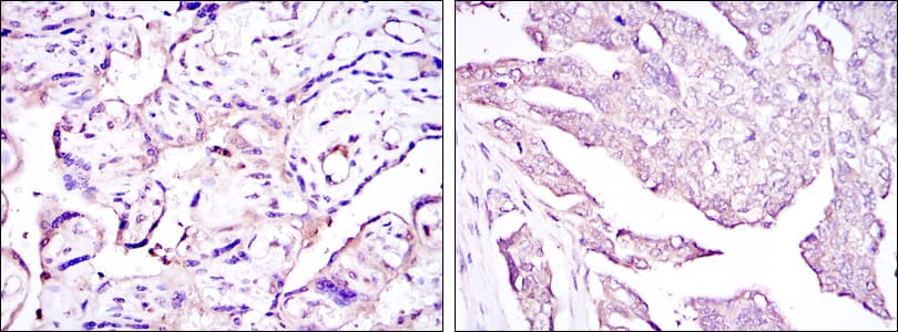 Monoclonal Mouse anti-Human HPV11 E7 Antibody (clone 6F3, IHC, WB)