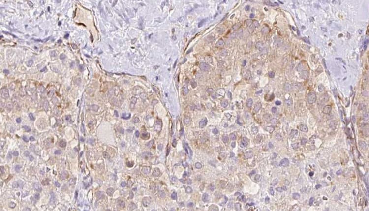 TBC1D23 Antibody