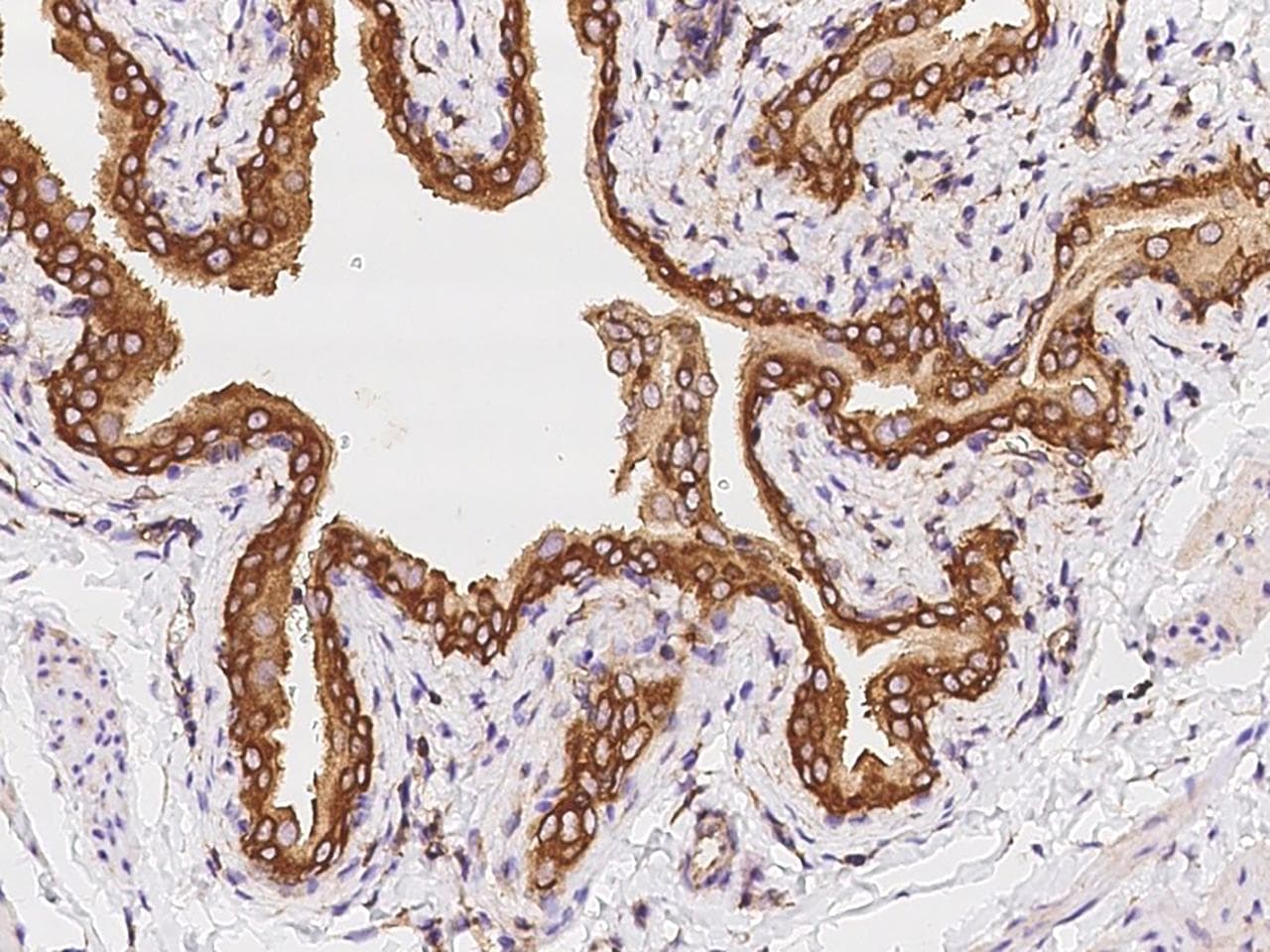 LAPTM4A Antibody
