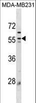 IHC-plus™ PLIN3 / M6PRBP1 / TIP47 Antibody (aa296-322)
