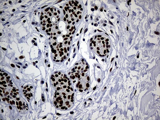 TP53BP1 / 53BP1 Antibody (aa1-300, clone OTI6D9, Carrier-free)