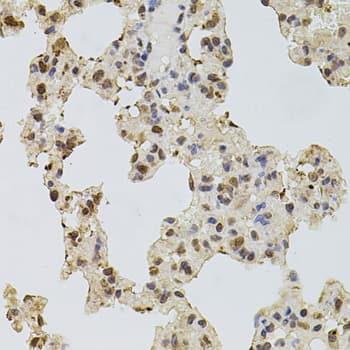 Polyclonal Rabbit anti-Human EGFR Antibody (IHC, IF, WB)