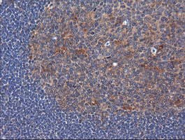 TCL / RHOJ Antibody (clone OTI1C8)