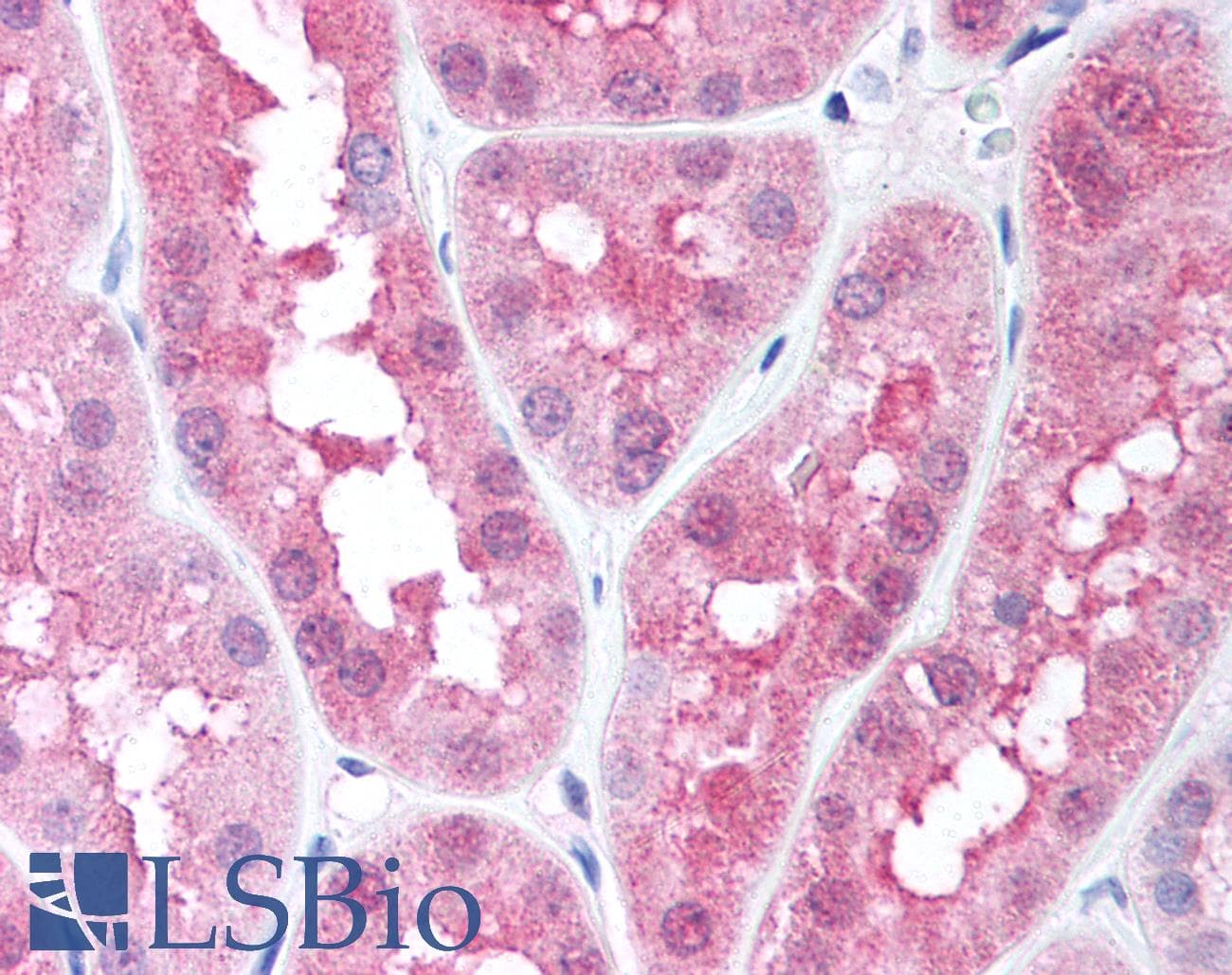 HIF1AN Antibody (C-Terminus, DY650)