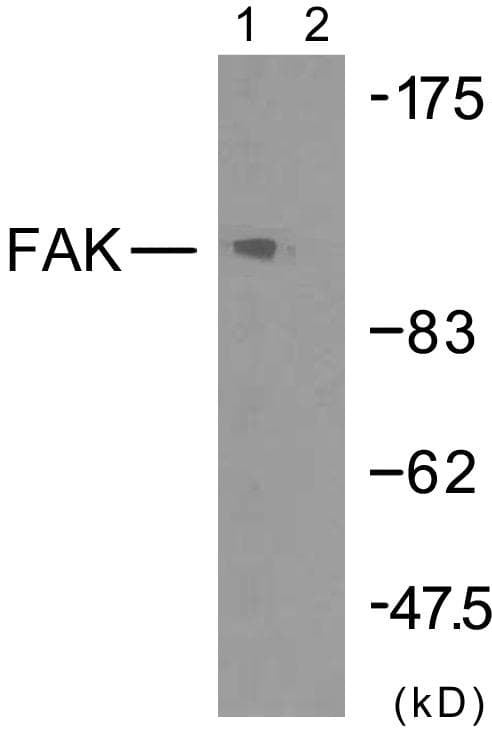 Polyclonal Rabbit anti-Human FAK / Focal Adhesion Kinase Antibody (p925, IHC, WB)