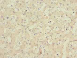 Polyclonal Rabbit anti-Human ALCAM / CD166 Antibody (IHC, WB)