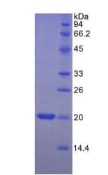 Human MYL2 Protein (Recombinant His)